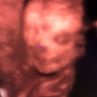 有没有孕妈24周的，胎动一直不明显正常吗，顺便猜下男孩女孩