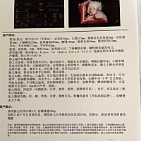 帮忙看下男宝女宝 谢谢