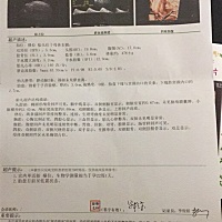 刚新鲜的四维，有没有大师能看出男女.