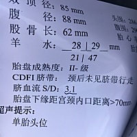 亲们这个S/D脐血流是什么意思啊，医生说偏高要我住院，我没住，不知道碍不碍事……