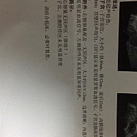 月经后的第六天差的，请问这个正常吗？