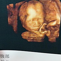 前两天做了四维都很好。  就是很好奇是男生还是女生。    等待着我的宝贝降临了