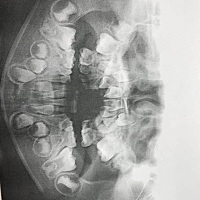 老公的小外甥，虽然我每次去都会讲解护牙的重要性，无奈妈妈比较宠孩子，导致孩子牙齿一天比一天恶化，...
