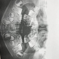 老公的小外甥，虽然我每次去都会讲解护牙的重要性，无奈妈妈比较宠孩子，导致孩子牙齿一天比一天恶化，...
