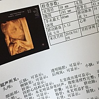 昨天四维检查通过了 第一次看到宝宝 之前两次检查医生说都是男孩 为嘛看到照片觉得好像小女生 觉得好小 ...