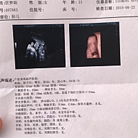 小伙伴们，是男孩女孩啊？很好奇。