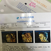 紧张好久的四维顺利通过啦…………就是特别好奇男宝女宝