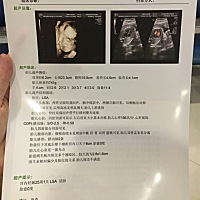 亲们，今天照的四维，想麻烦大家看看怎么样，还有左心室见强光点是什么情况？