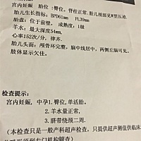 25周+1宝宝晚上胎动的有没有.不知道是男是女