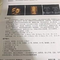 宝妈们，帮我看看男孩还是女孩