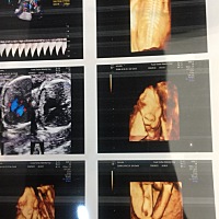 今天约了做四维、照了三次才做好！下面请有经验的孕妈们帮忙看下这是男宝还是女宝