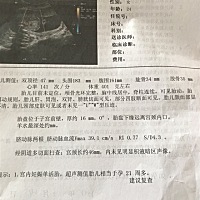 大家帮我看看男孩 女孩？