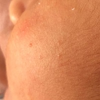 宝宝脸上有小红点，身上也有几个，怎么回事啊