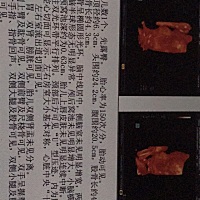 有经验的亲们，来看看是男宝宝还是女宝宝