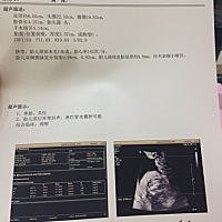 看大家顺顺利利的真的十分羡慕，为什么我这么坎坷……从12周nt没有通过就开始，24周了，还是有问题，最...