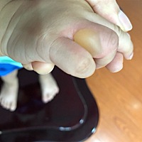 宝宝，妈妈对不起你，开水烫到手了，不停哭，要我抱，我还生他气，怪他倒得到处都是水，没有及时处理伤...