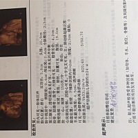 五个月的时侯做B超说是男宝，六个月做四维说是女宝，有懂的么大家帮忙看看是男宝还是女宝