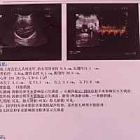 这个彩超能看出来男女吗，我不会看，又会看的吗