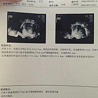 麻烦各位给看看，我能怀孕吗？