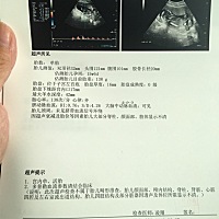 好奇心爆棚，谁能看出来男女