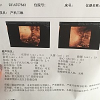 宝妈们。帮我看看是男宝女宝