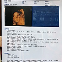 今天四维做好啦✌️