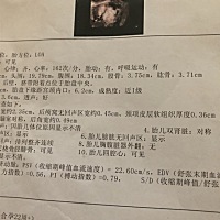 今天做了三维检查！宝宝蛮不配合的，老不翻身，一直看不到上嘴唇，其他都是正常的，下周再去复查上嘴唇...