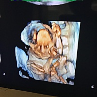 有没有宝爸宝妈能看出来男女的，很好奇。