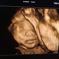 从早到晚呆医院，反反复复打了7遍下才看到脸！接好孕～像不像我