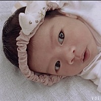 12天～ 睡觉前还都是双眼皮，睡醒了怎么一只变单了呢