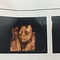 男孩还是女孩呢？怎么觉得这鼻子好挺呢？头胎纯属好奇。23周的三维彩超