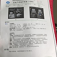 大家帮我看看男女