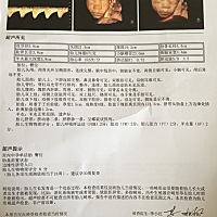 四维归来，什么脐带从胎盘边缘插入，有同情况的宝妈吗？