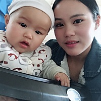 亲爱的你们有没有产后严重掉发的啊？