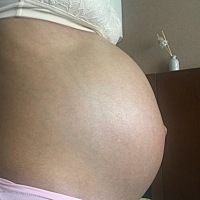 我的小左和小右。小左左侧脑轻度增宽，希望下周检查能看到好消息！