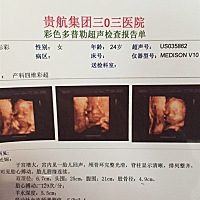 谁给我看看是儿子还是女儿，感觉好期待啊👧