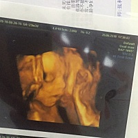 四维通过、我的宝贝，看到你那刻心都融化了，祝所有孕妈们都好孕