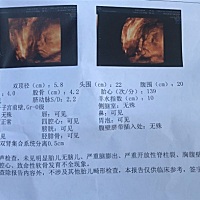 求宝妈们帮我看一下男宝女宝