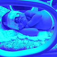 宝宝20号下午出生 25号早上黄疸高照蓝光 好心疼