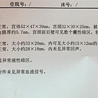 卵泡监测结果，亲们帮我看下正常吗？多少mm可以同房