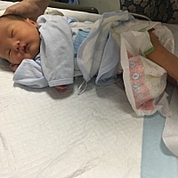 宝宝出生12天有黄疸怎么办