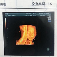 帮忙判断下男宝女宝。