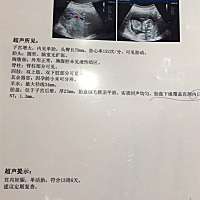 NT通过，好奇是男宝宝还是女宝宝。