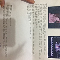 有没有宝妈会看男女的，二胎的。