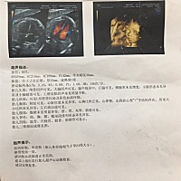 谁帮我看看是男女。谢谢