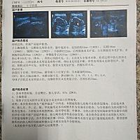 昨天做了中孕彩超，单子和大家分享下，大家一起八卦下，是男是女？
