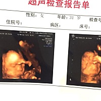 不学舞蹈可惜咯，小脚丫踢到脑门上了[偷笑][偷笑]脸紧紧的贴在胎盘，丑的不要不要的[捂脸][捂脸]