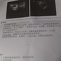 今天月经第20天，亲们有和我一样的嘛