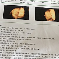 不咋像我😄。幺儿，妈妈爱你