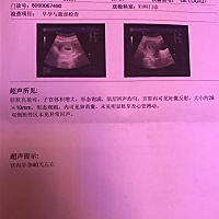 各位宝妈，帮我看看，那天去检查停经51天，B超显示早孕40天左右，相当于发育晚一周，会不会有事